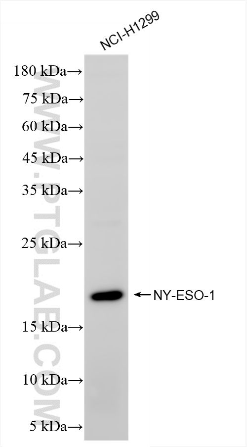 WB analysis of NCI-H1299 using 85355-1-RR