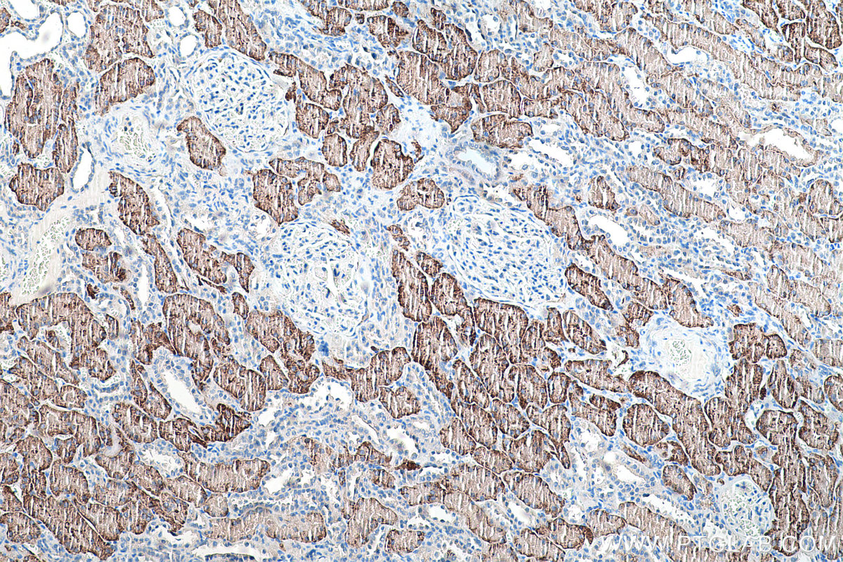 IHC staining of human kidney using 26184-1-AP