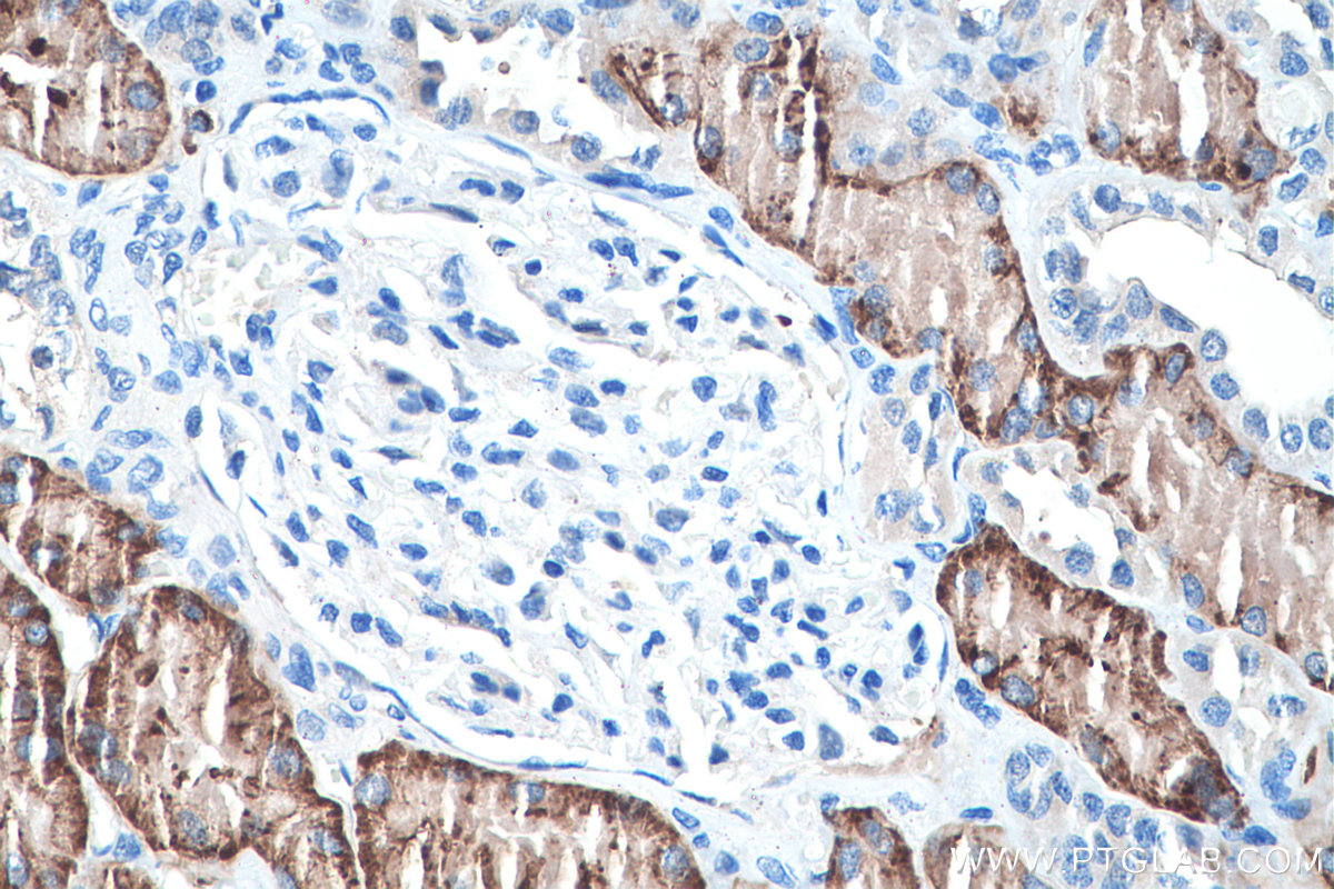 IHC staining of human kidney using 26184-1-AP