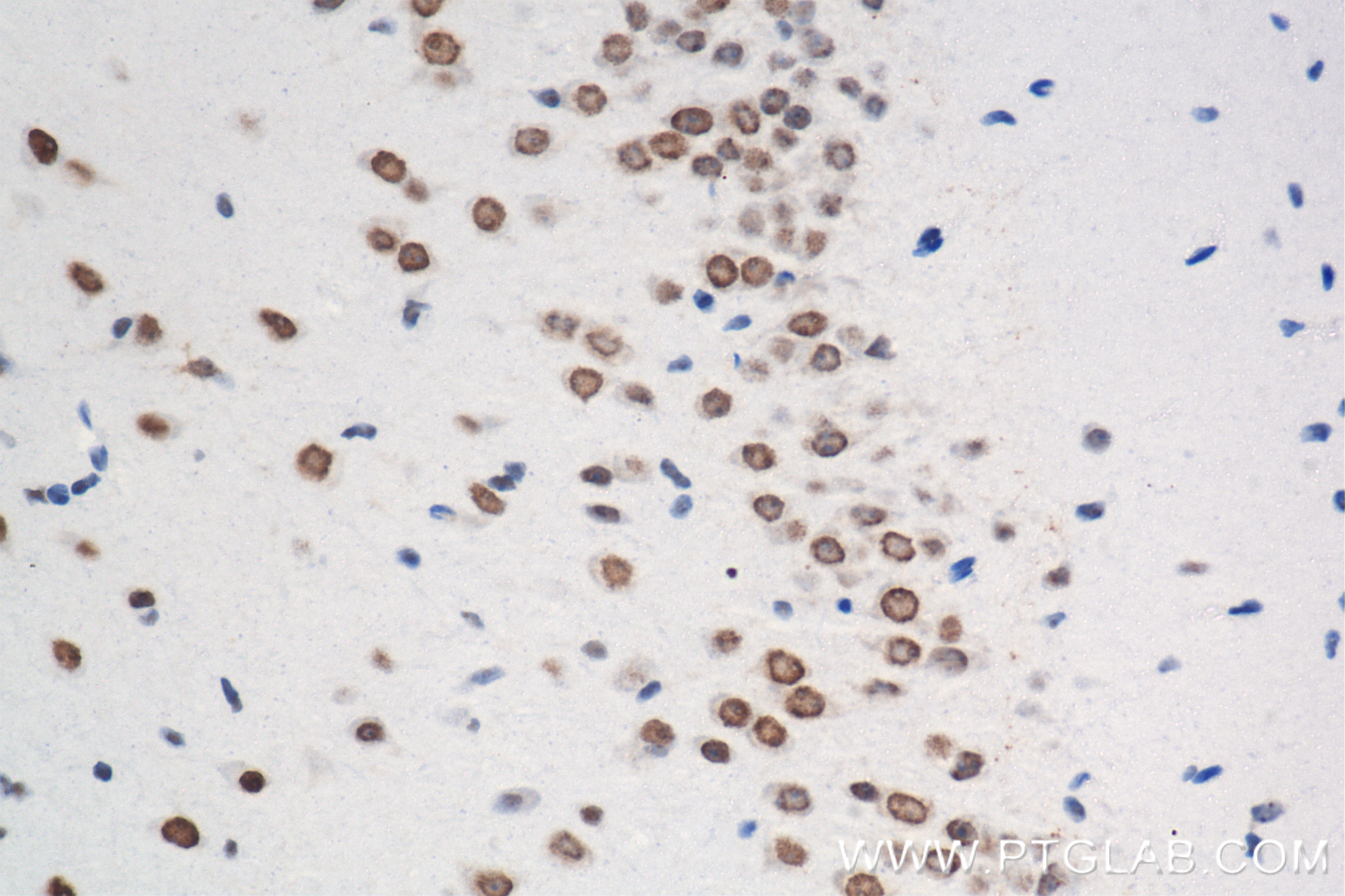 IHC staining of mouse brain using 80210-13-RR