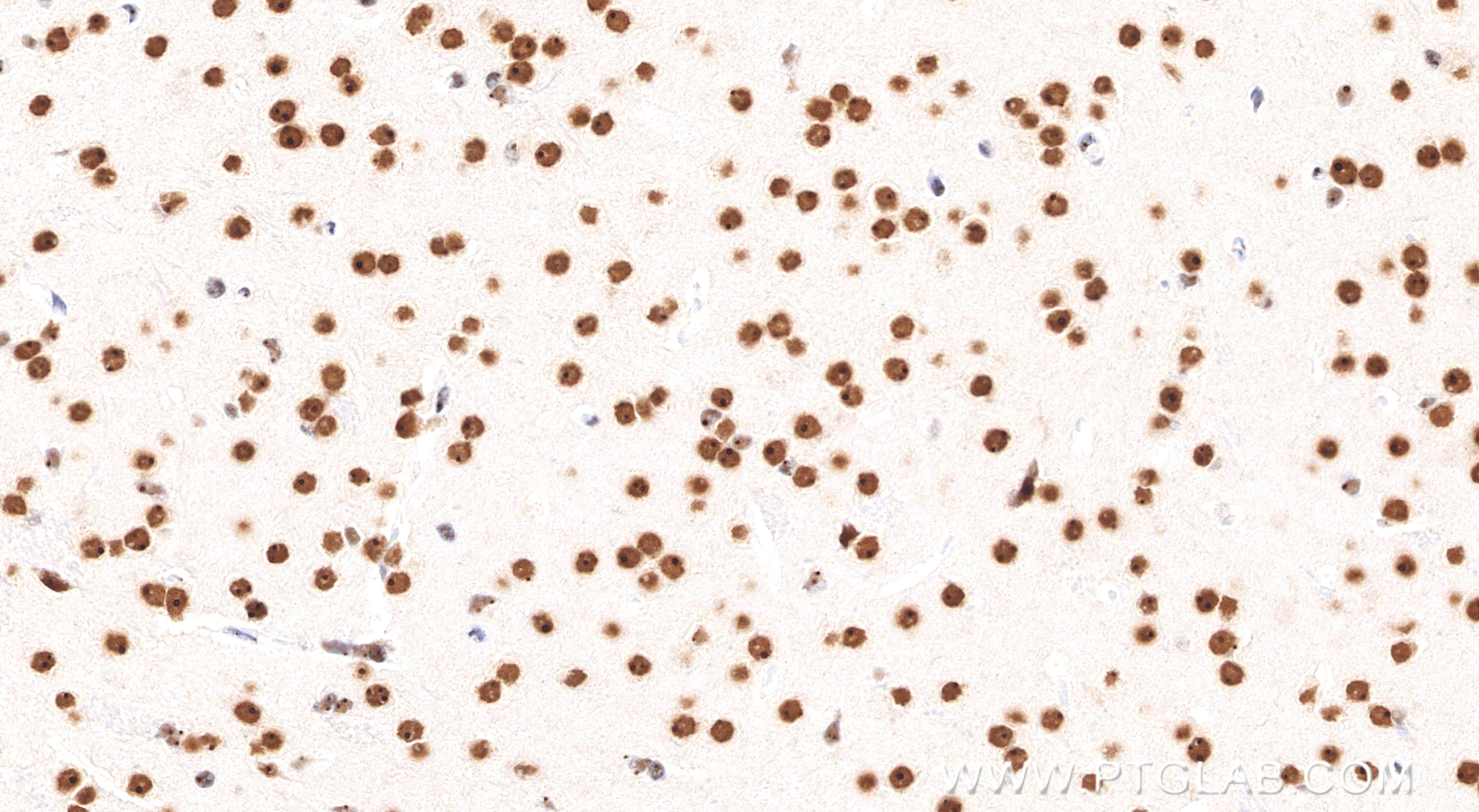 Immunohistochemical analysis of paraffin-embedded mouse brain tissue slide using <a class='green' href='/productredirect?CatalogNo=80210-13-RR' target='_blank'>80210-13-RR</a> (Nanog antibody) at dilution of 1:500 (under 40x lens). Heat mediated antigen retrieval with Tris-EDTA buffer (pH 9.0). This data was developed using the same antibody clone with 80210-13-PBS in a different storage buffer formulation. IHC staining of mouse brain using 80210-13-RR (same clone as 80210-13-PBS)