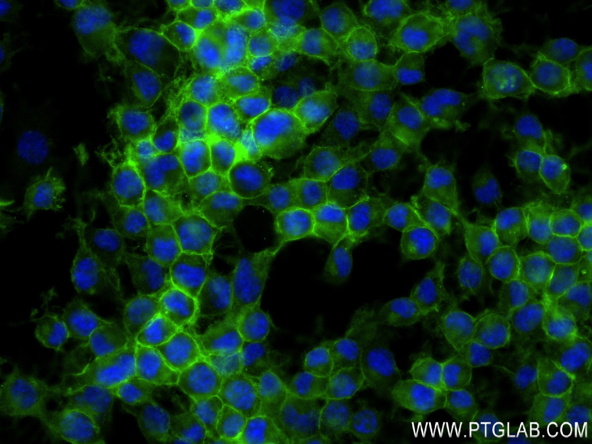 IF Staining of Neuro-2a using 83883-5-RR