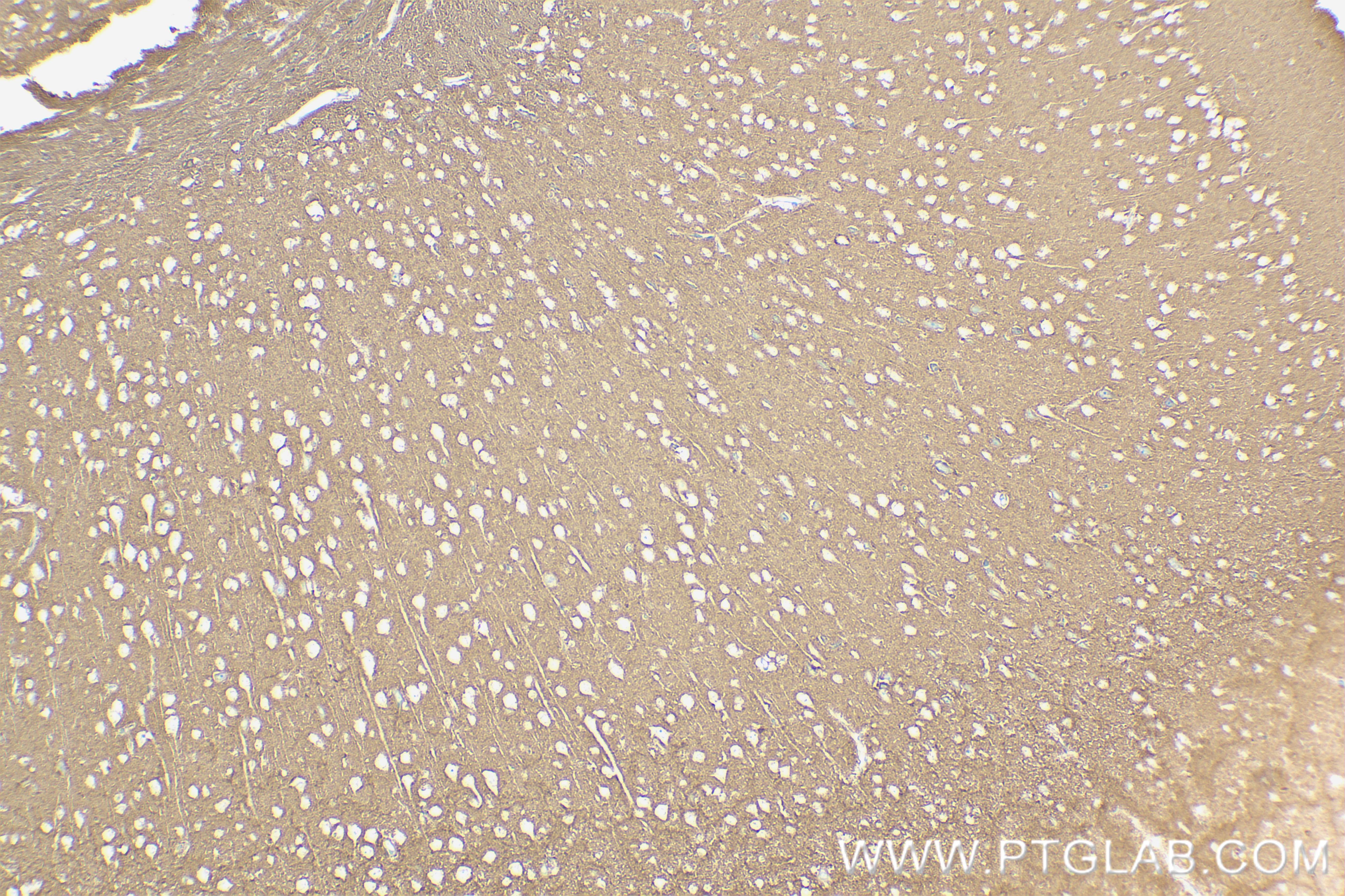 IHC staining of mouse brain using 83883-5-RR