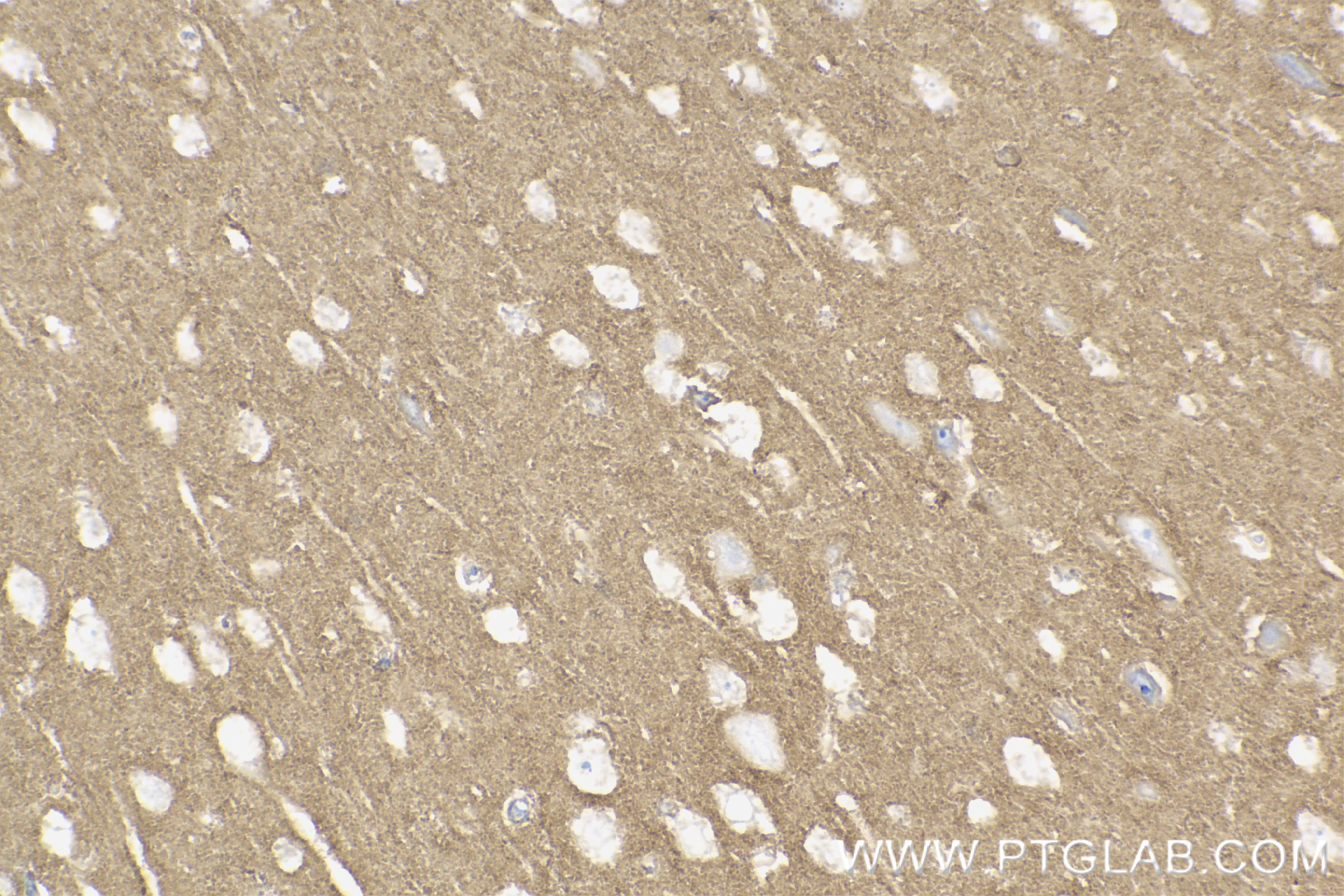 IHC staining of mouse brain using 83883-5-RR