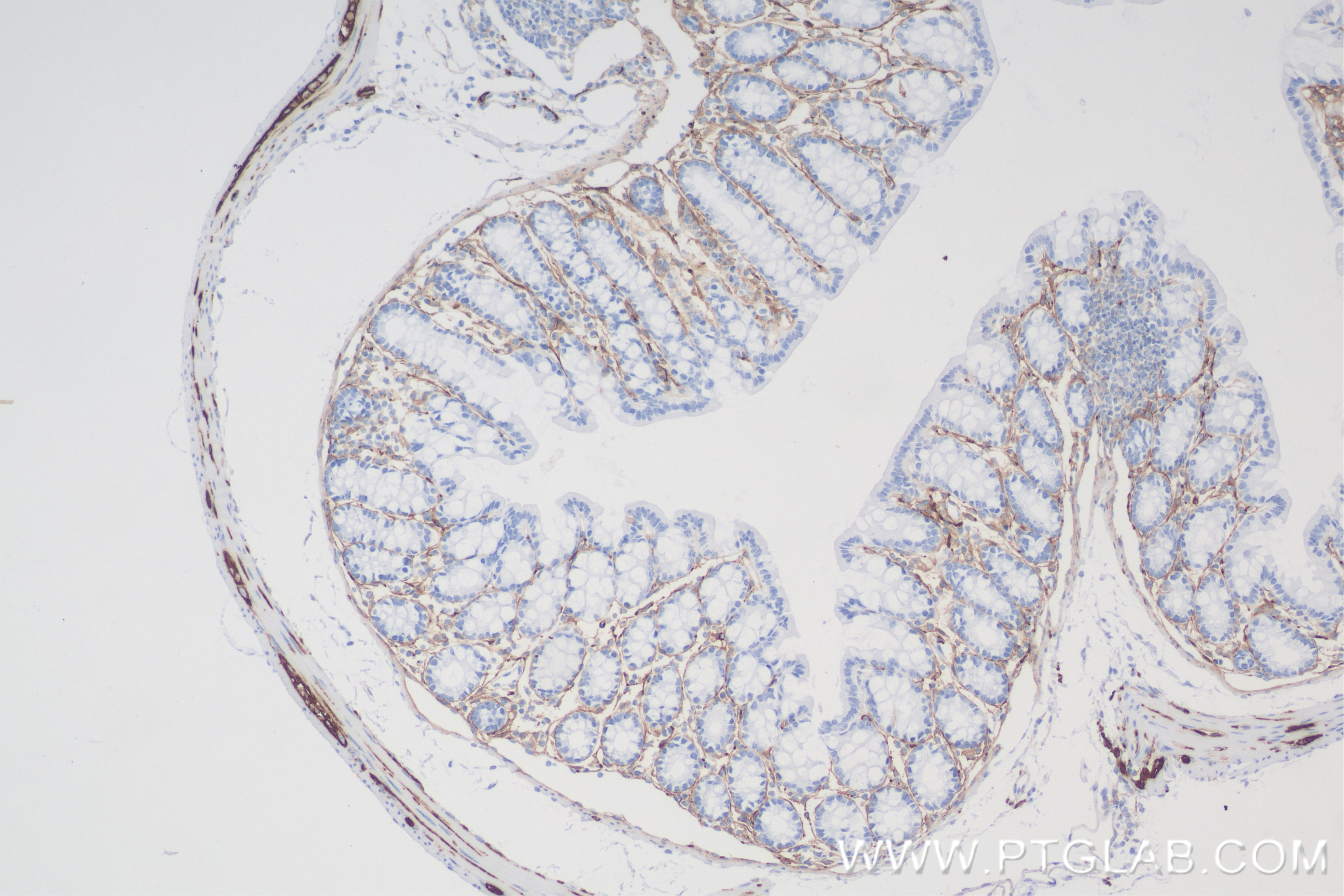 IHC staining of mouse colon using 83883-5-RR