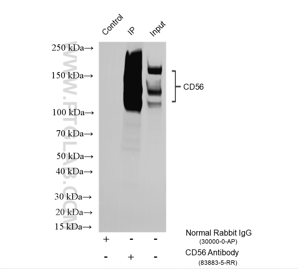 IP experiment of mouse brain using 83883-5-RR IP experiment of mouse brain using 83883-5-RR