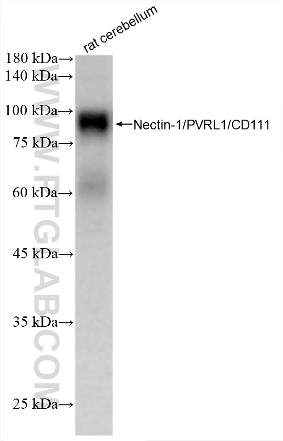 WB analysis of rat cerebellum using 88101-1-RR WB analysis of rat cerebellum using 88101-1-RR