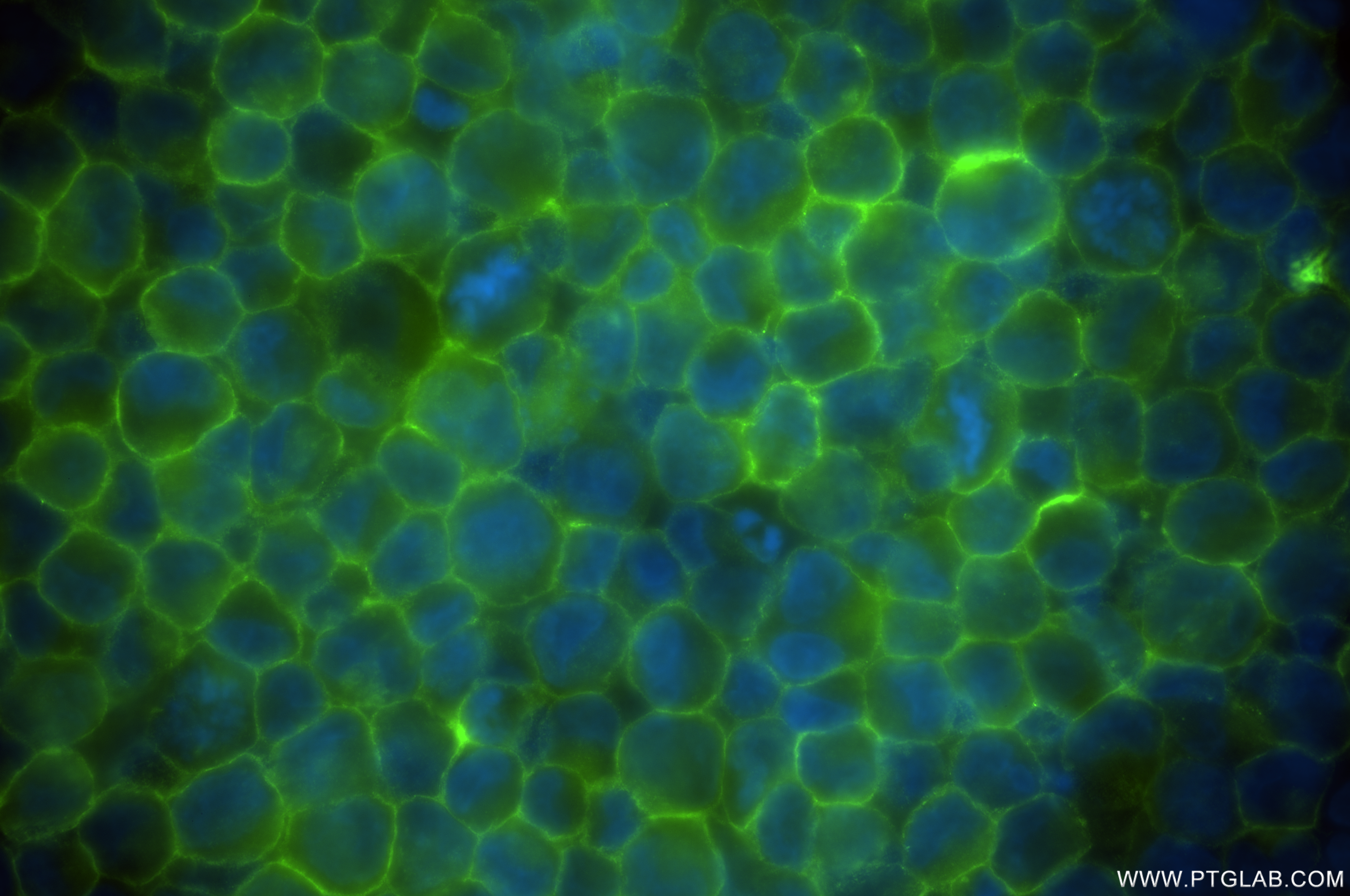IF Staining of K-562 using 84460-5-RR