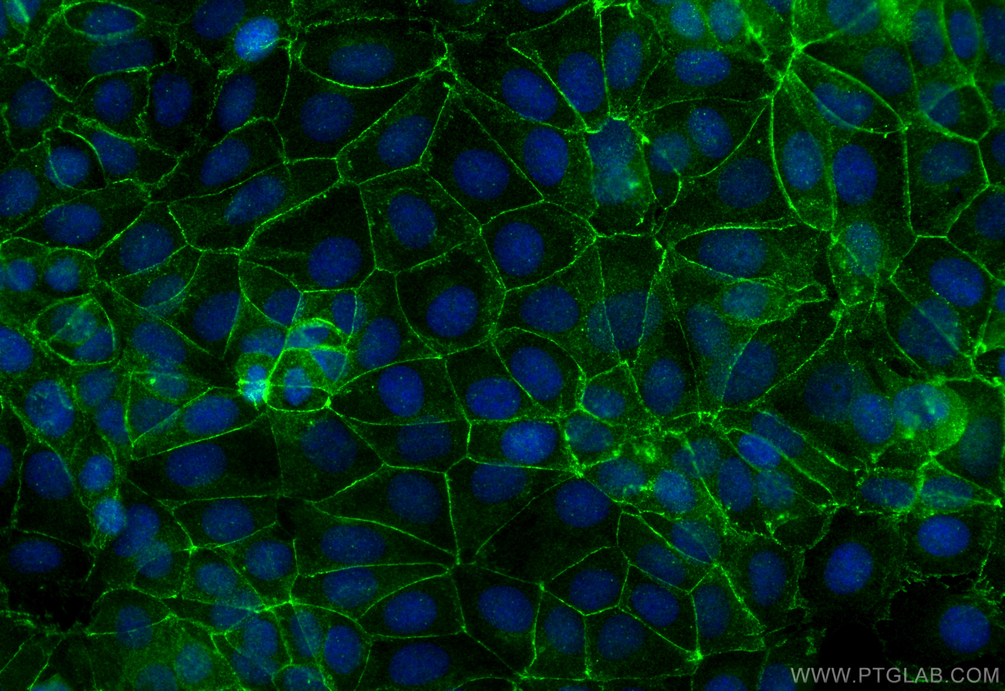 IF Staining of MCF-7 using 31026-1-AP