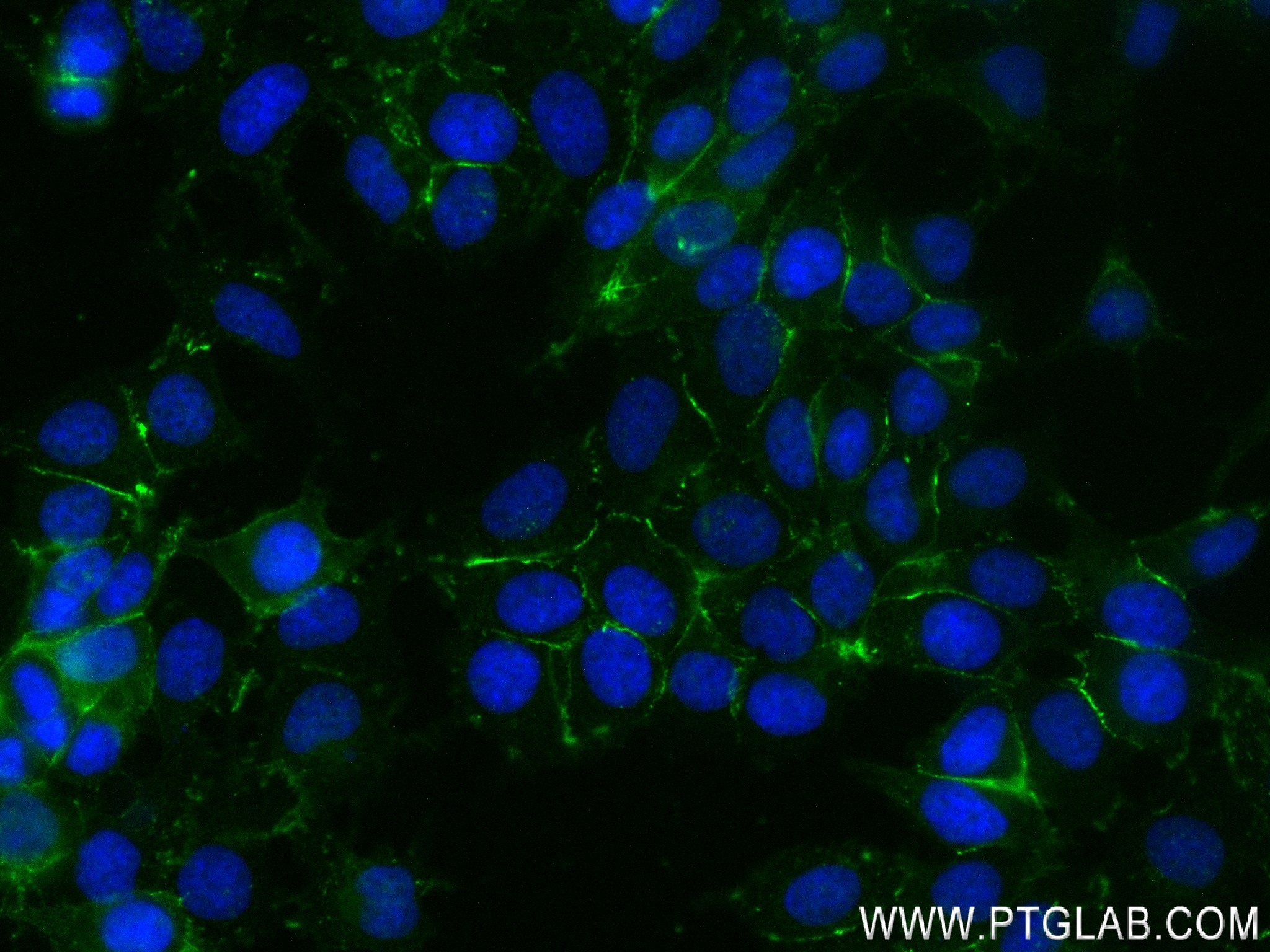 IF Staining of MCF-7 using 83223-4-RR (same clone as 83223-4-PBS)