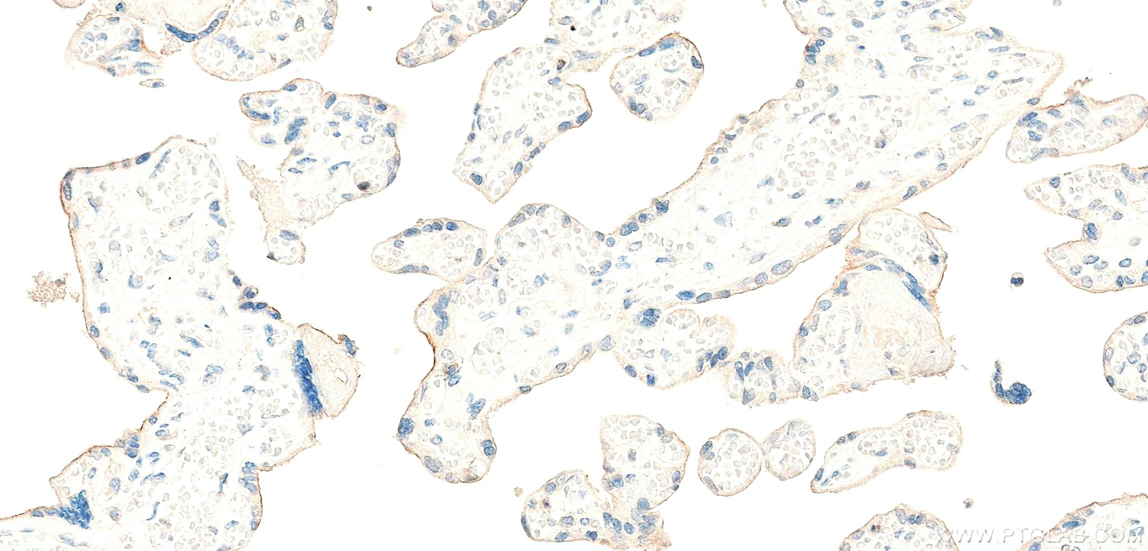IHC staining of human placenta using 83223-4-RR IHC staining of human placenta using 83223-4-RR