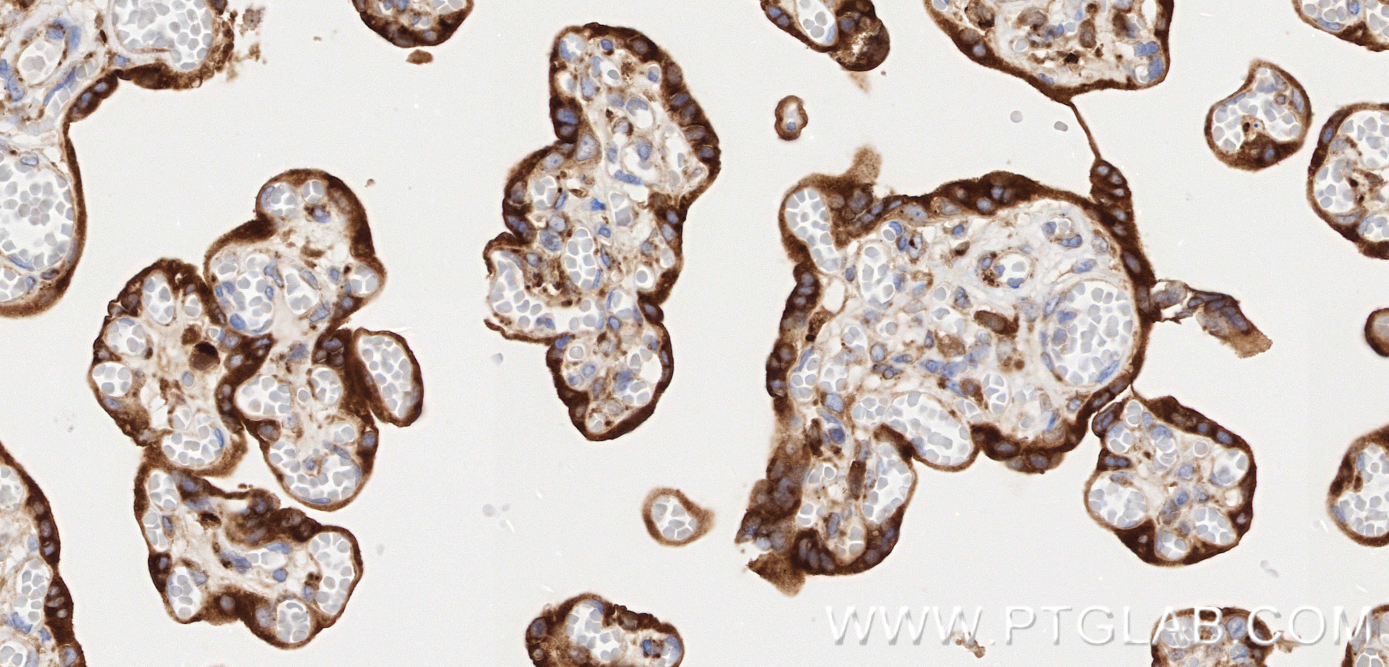 IHC staining of human placenta using 83223-6-RR