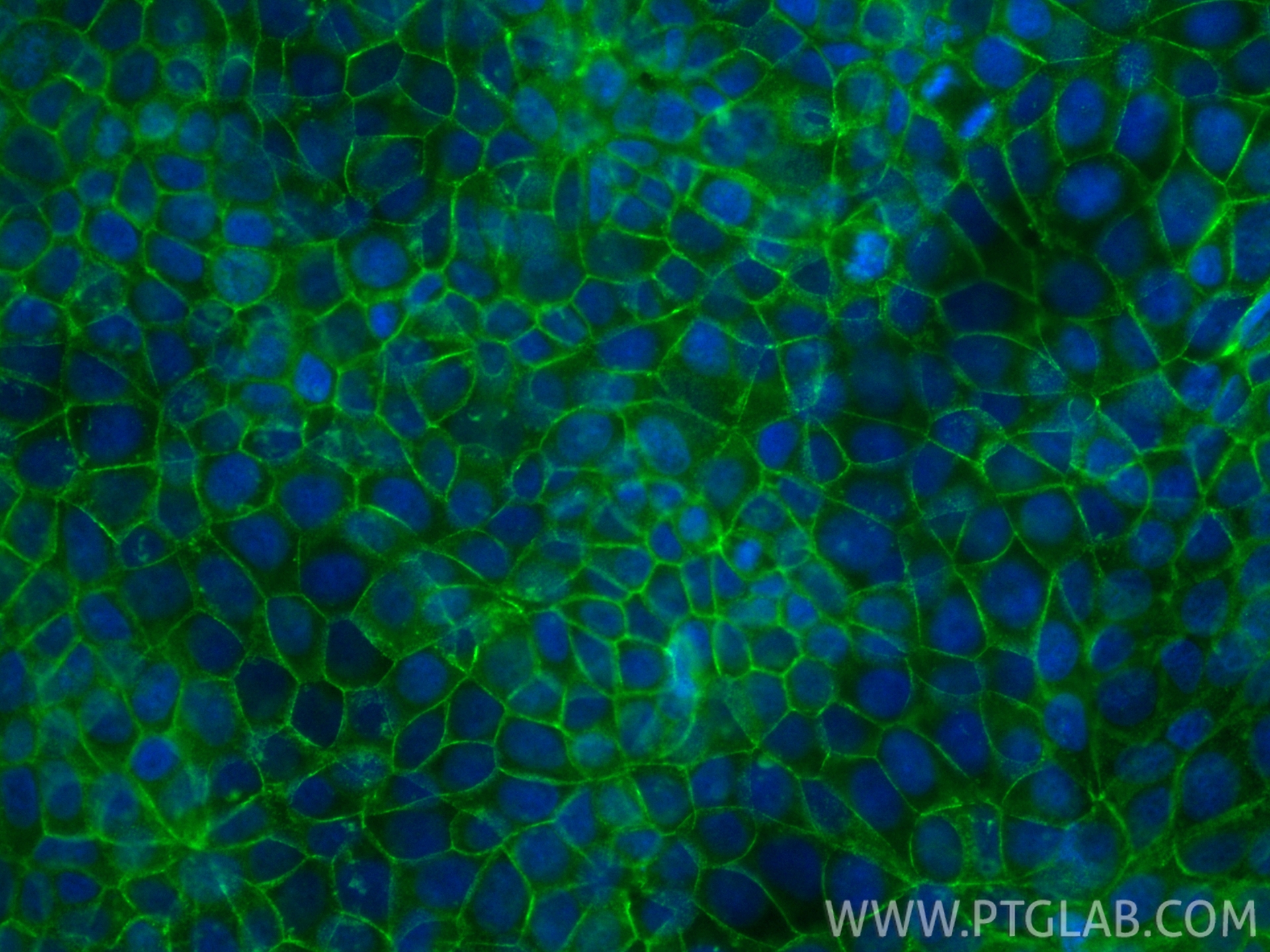 IF Staining of MCF-7 using CL488-21903