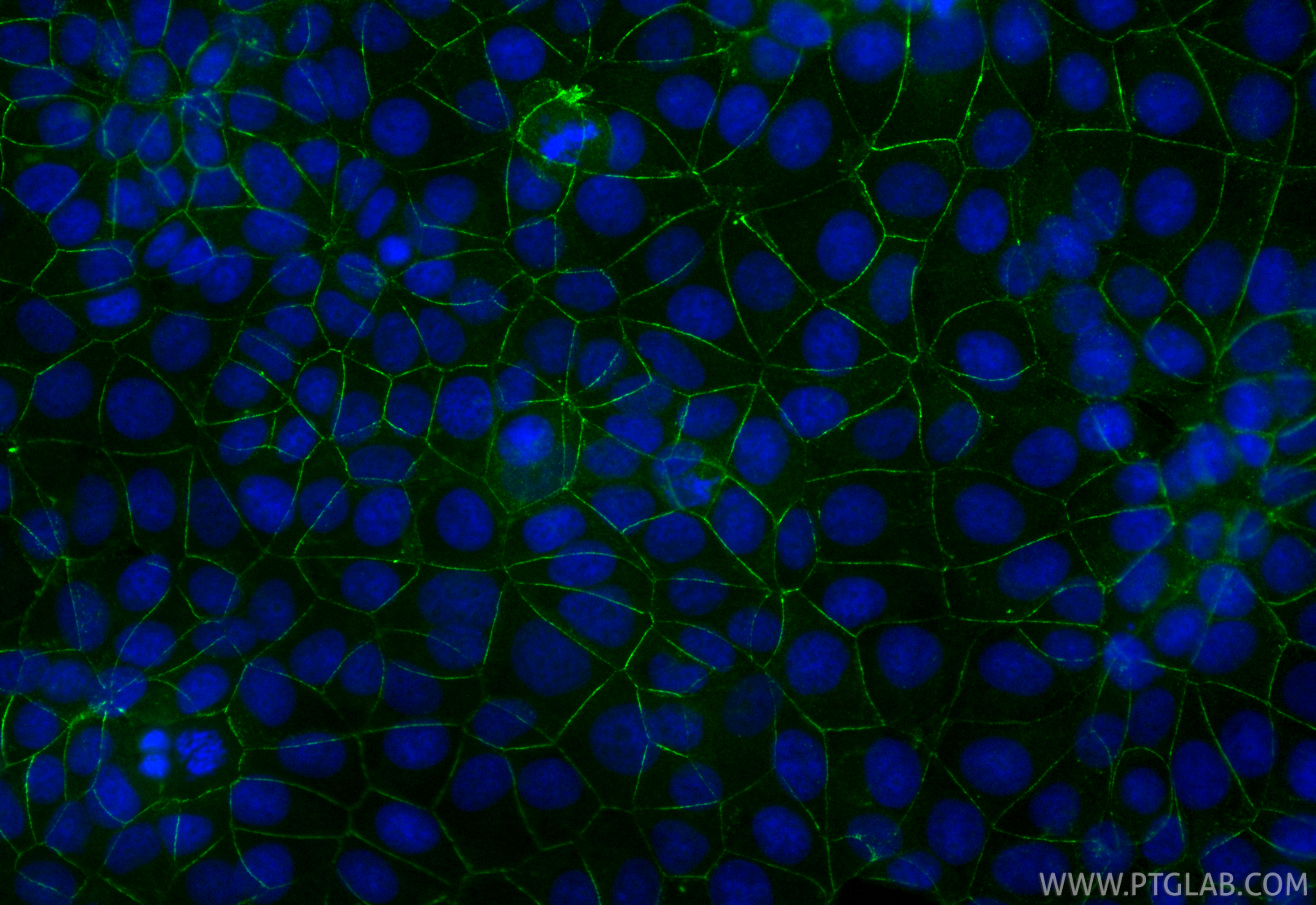 IF Staining of MCF-7 using CL488-83223-4