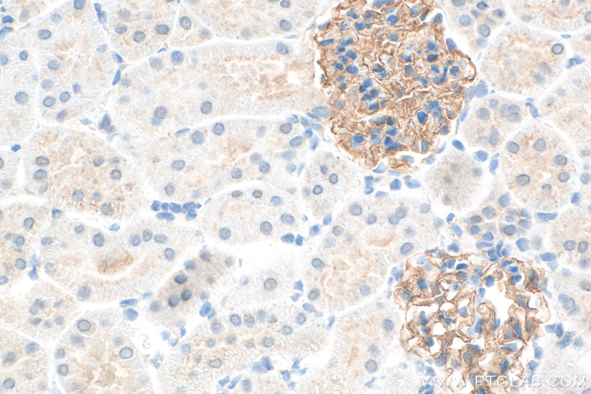 Nephrin