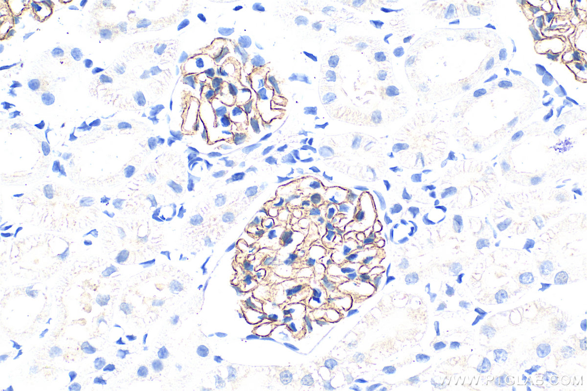 IHC staining of rat kidney using 22912-1-AP