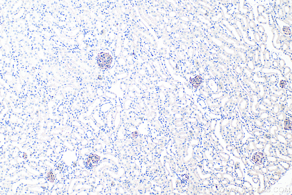 IHC staining of mouse kidney using 22912-1-AP