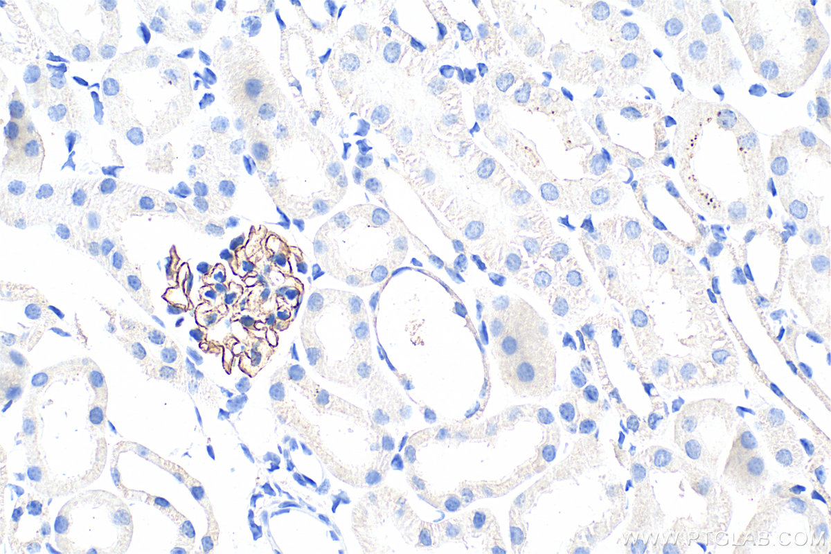 IHC staining of mouse kidney using 22912-1-AP