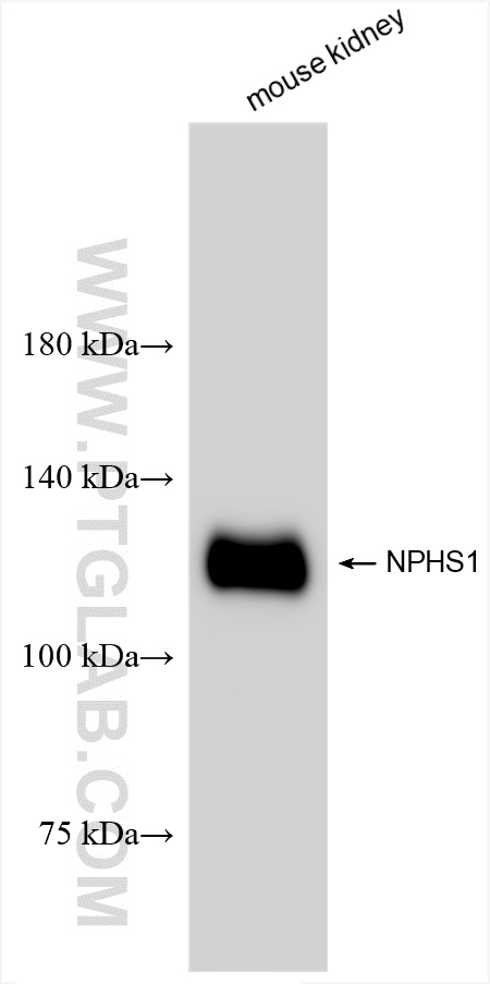 WB analysis of mouse kidney using 85845-1-RR