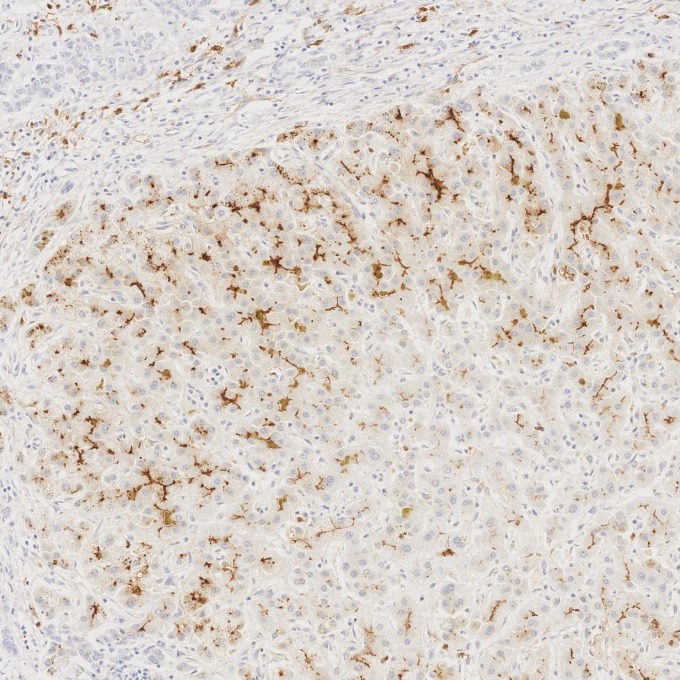 IHC staining of human liver using 84181-1-RR IHC staining of human liver using 84181-1-RR