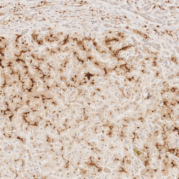 IHC staining of human liver using 84181-1-RR IHC staining of human liver using 84181-1-RR