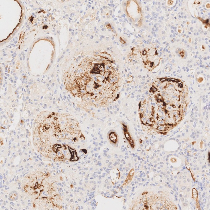 IHC staining of human kidney using 84181-1-RR IHC staining of human kidney using 84181-1-RR