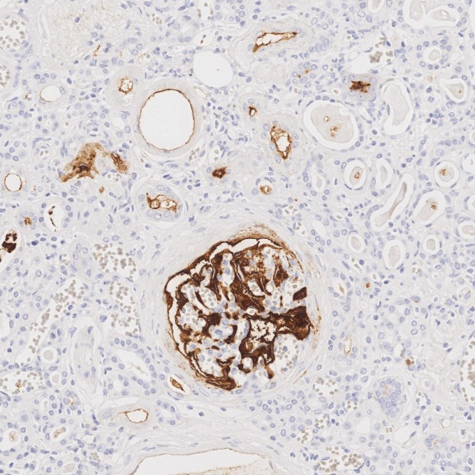 IHC staining of human kidney using 84181-1-RR IHC staining of human kidney using 84181-1-RR