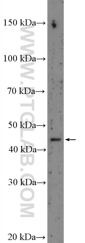 Nesprin 4