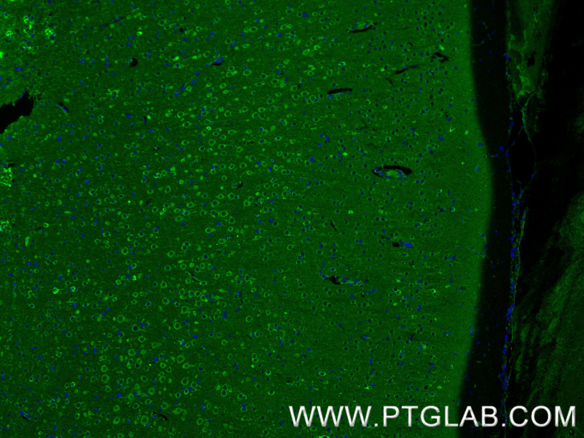 IF Staining of rat brain using 80293-5-RR IF Staining of rat brain using 80293-5-RR