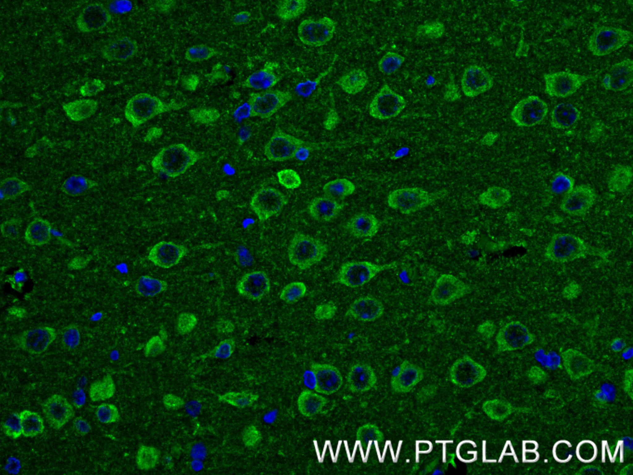 IF Staining of rat brain using 80293-5-RR IF Staining of rat brain using 80293-5-RR