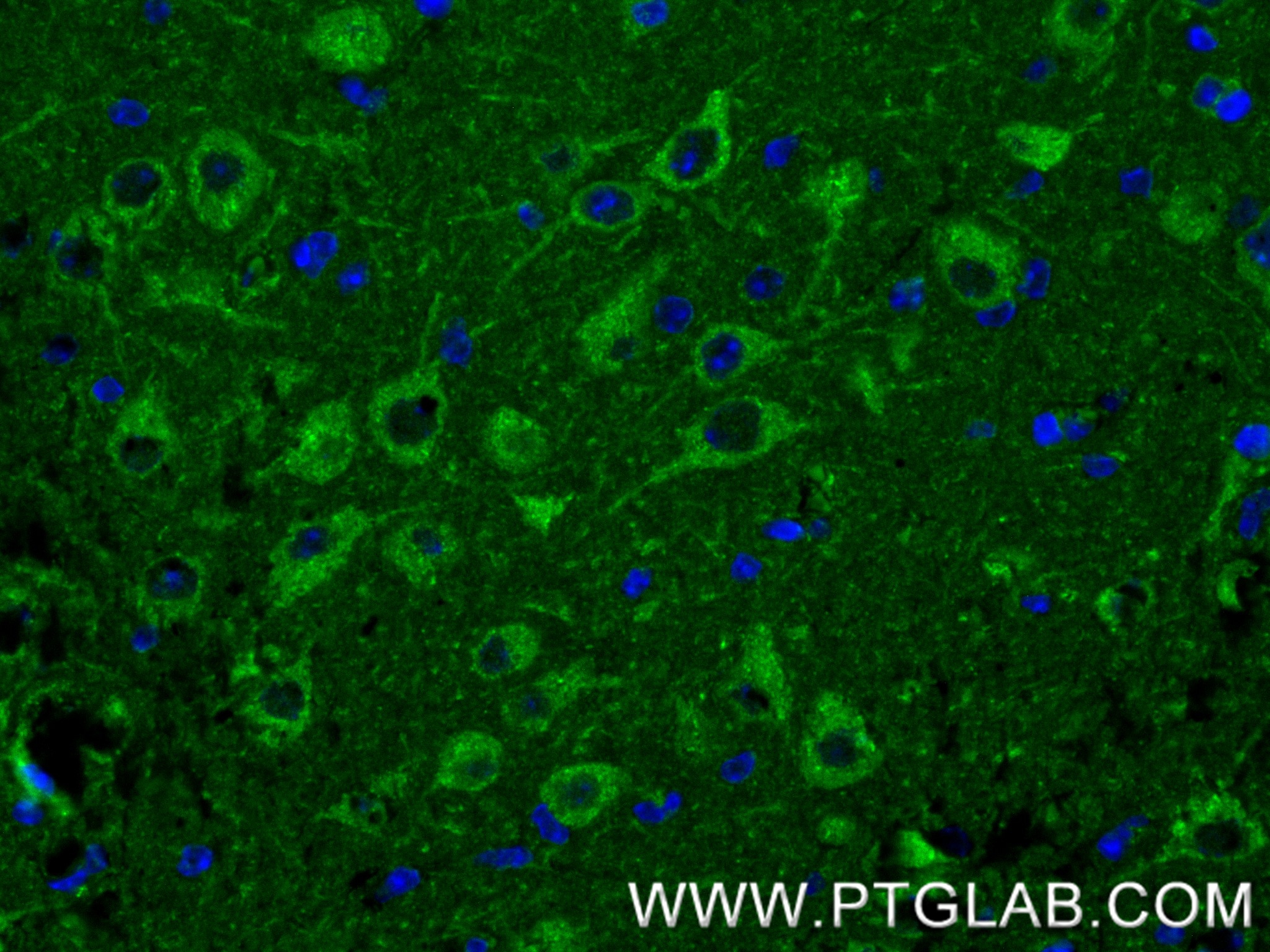 IF Staining of mouse brain using 80293-5-RR IF Staining of mouse brain using 80293-5-RR
