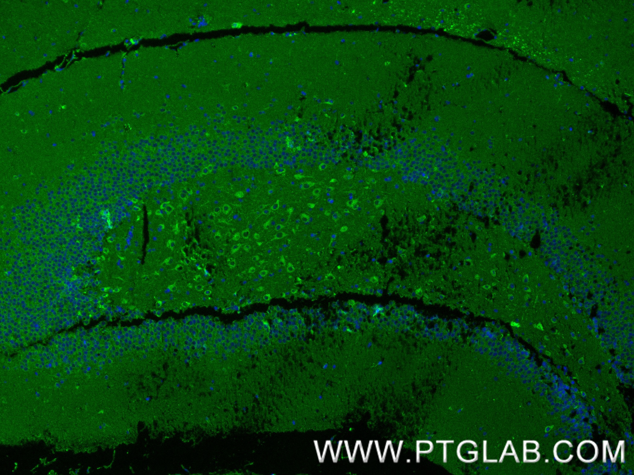 IF Staining of mouse brain using 80293-5-RR IF Staining of mouse brain using 80293-5-RR