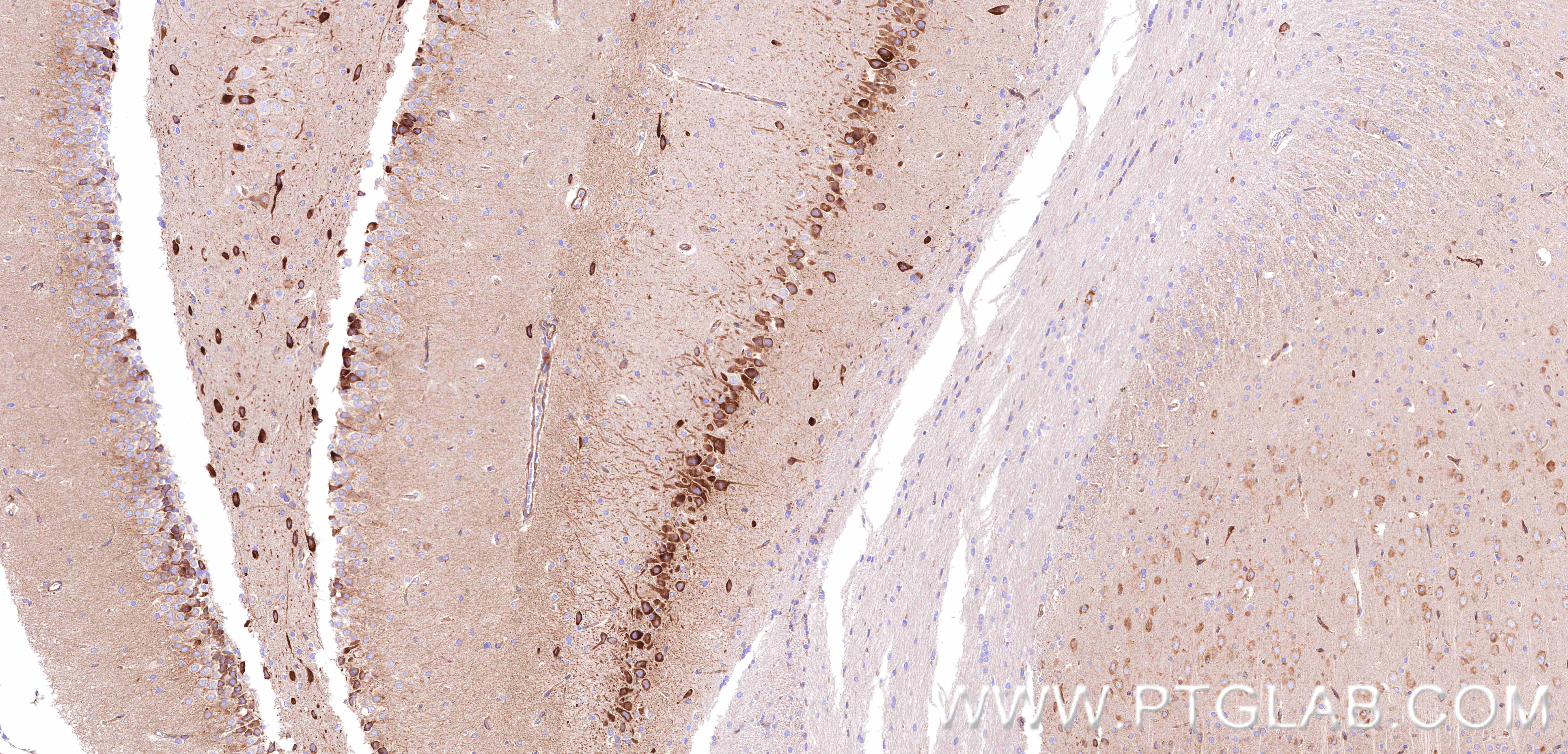 IHC staining of rat brain using 80293-5-RR IHC staining of rat brain using 80293-5-RR