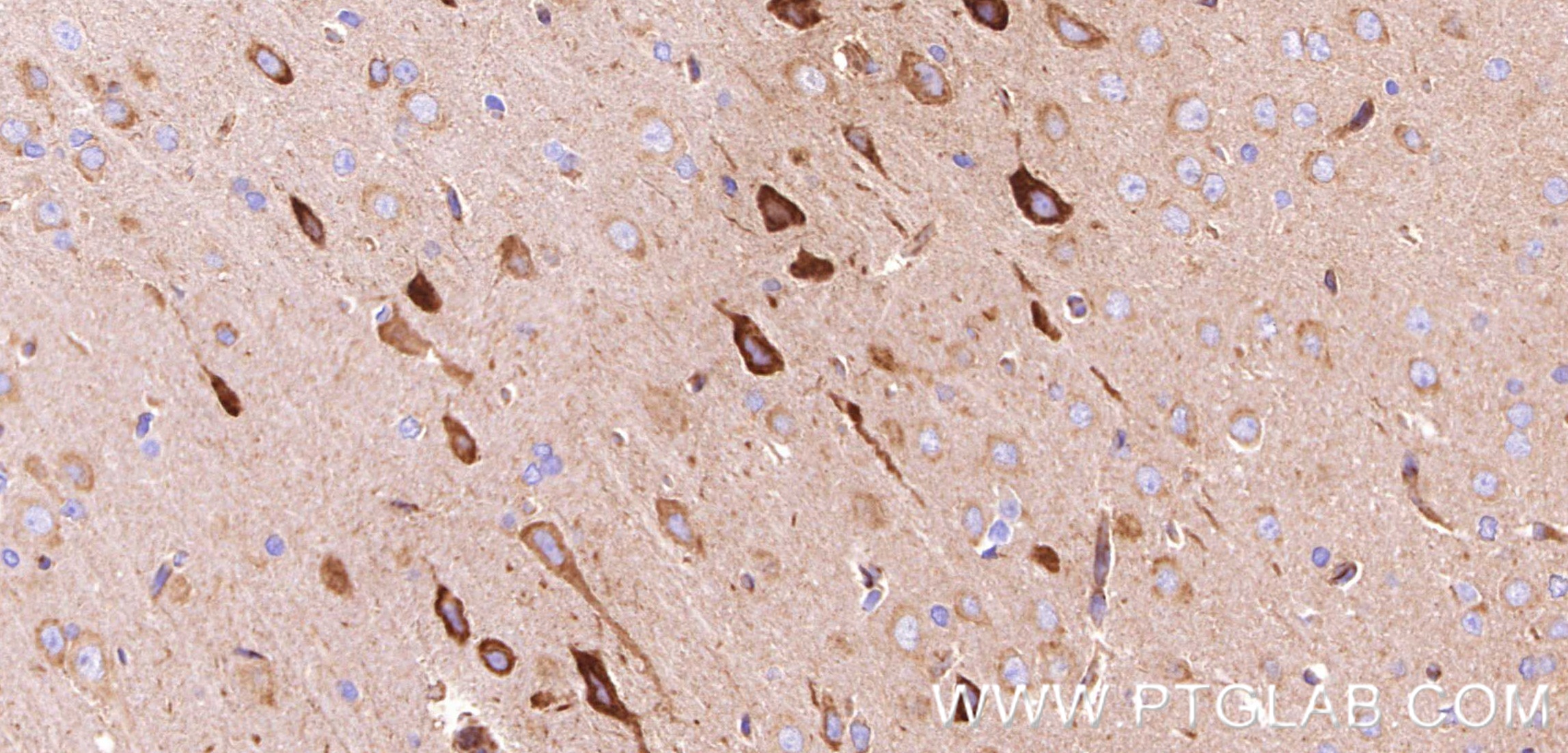 IHC staining of rat brain using 80293-5-RR IHC staining of rat brain using 80293-5-RR