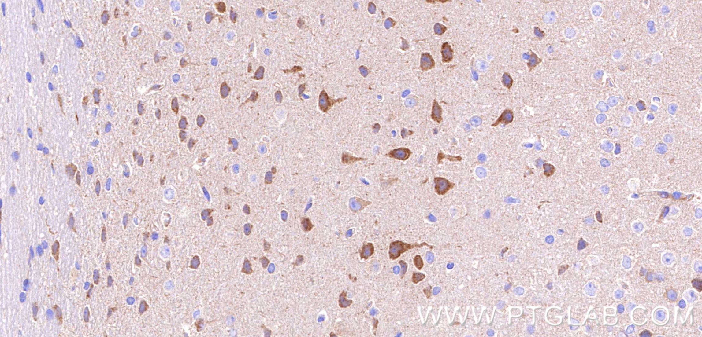 IHC staining of mouse brain using 80293-5-RR IHC staining of mouse brain using 80293-5-RR