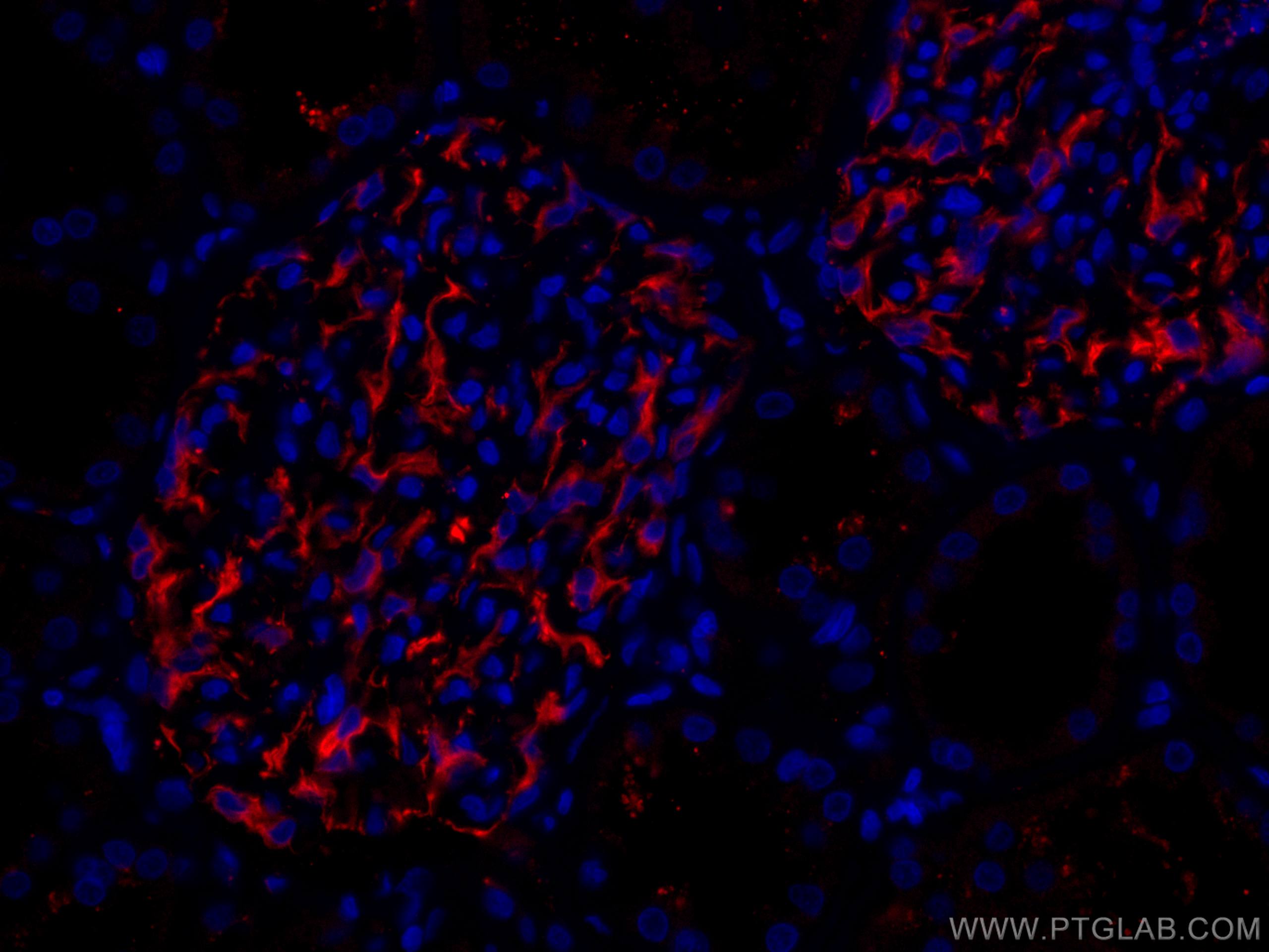 IF Staining of human kidney using CL594-19483