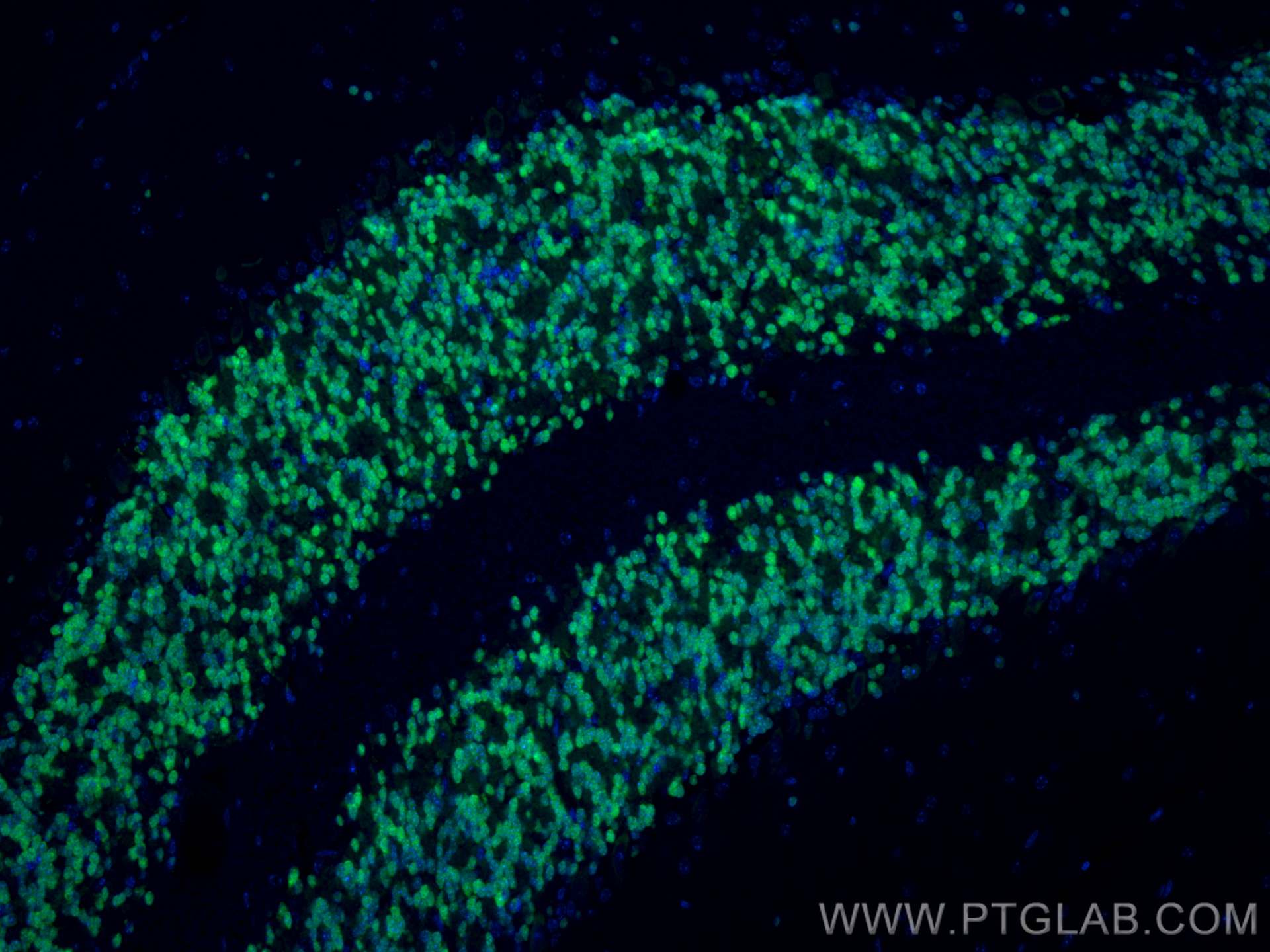 IF Staining of mouse cerebellum using 26975-1-AP