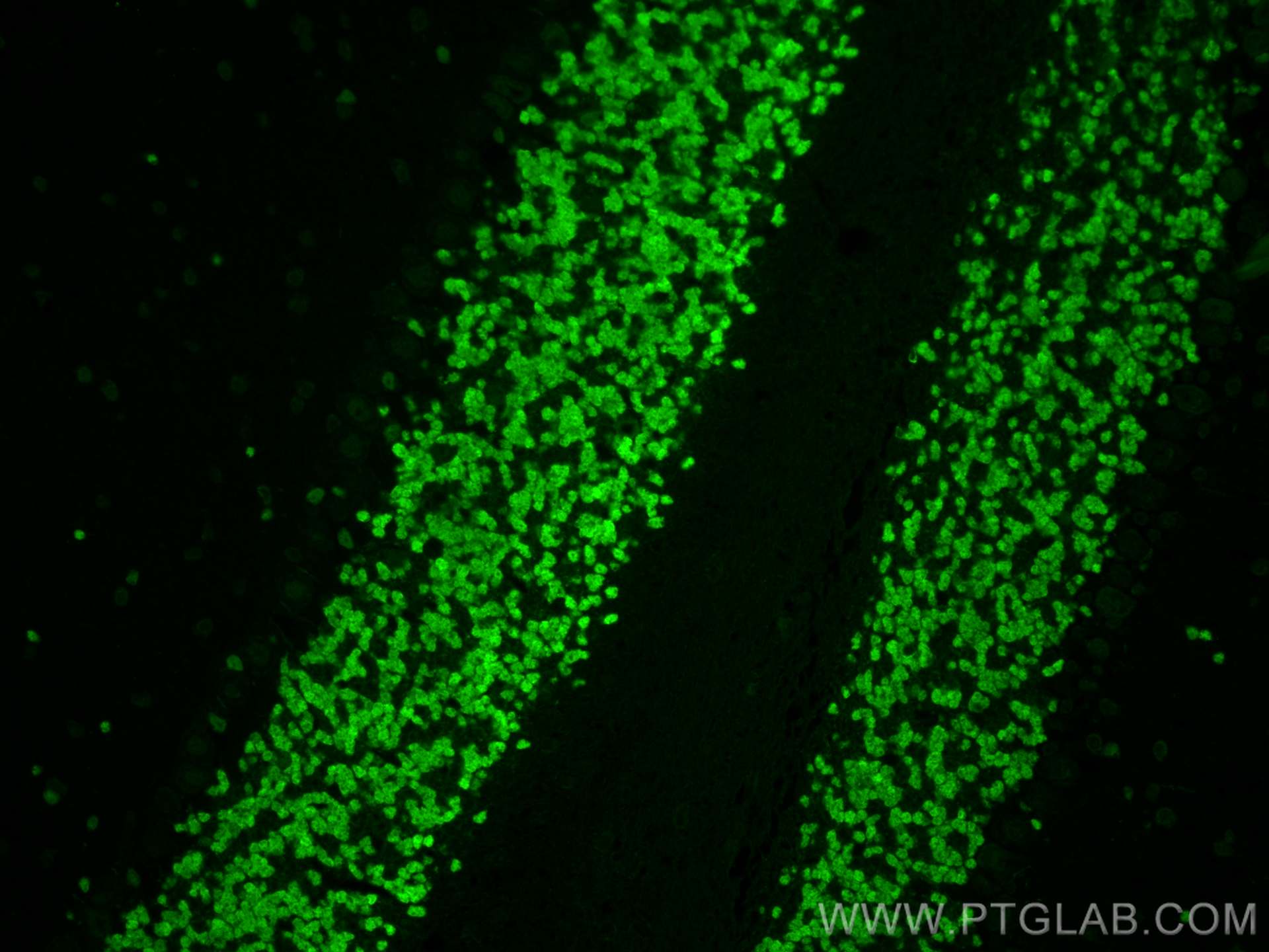 IF Staining of mouse cerebellum using 26975-1-AP