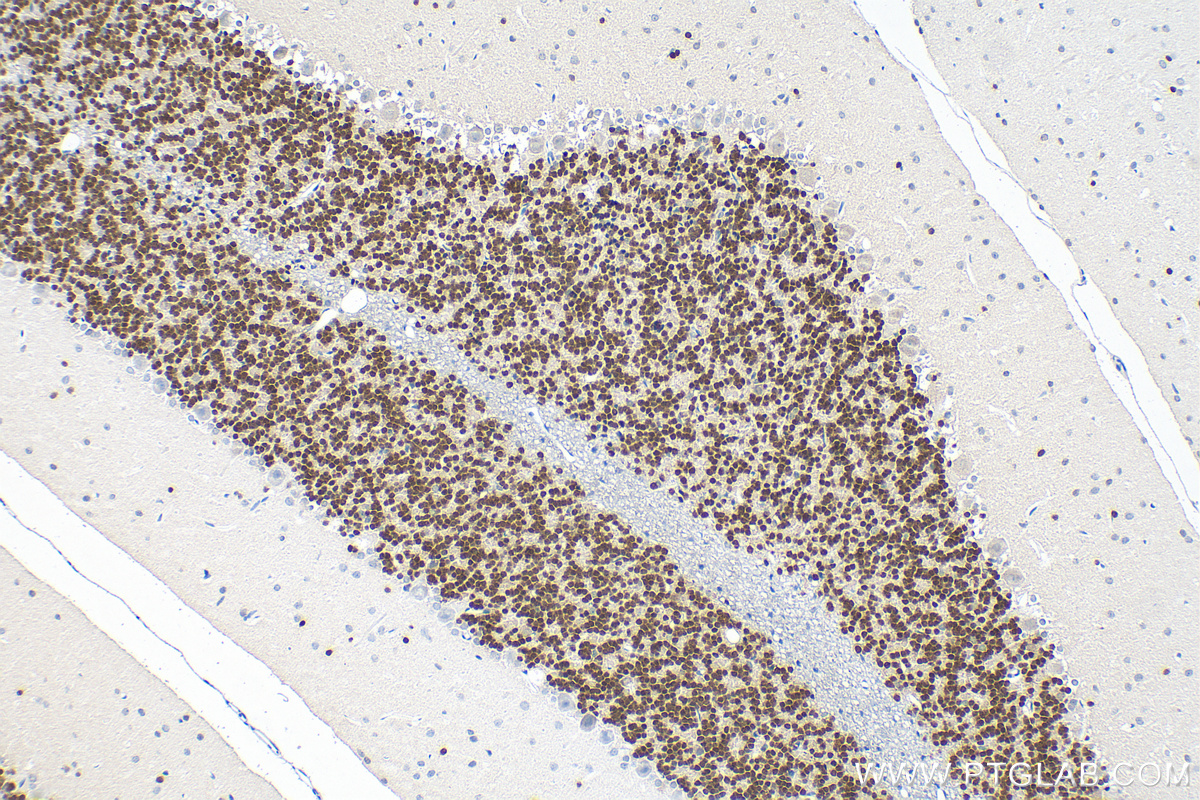 IHC staining of rat cerebellum using 26975-1-AP