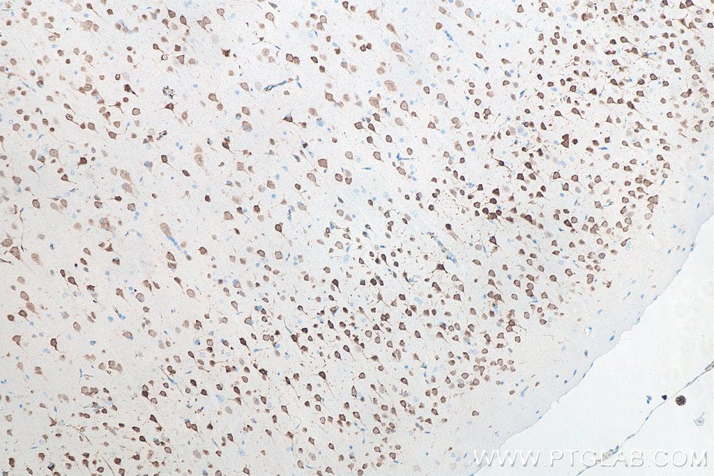 IHC staining of rat brain using 66836-1-Ig
