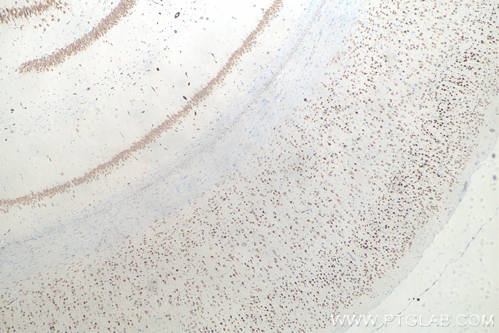 IHC staining of rat brain using 66836-1-Ig