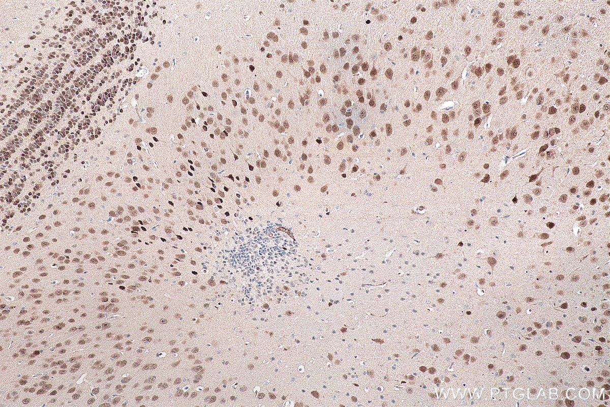 IHC staining of mouse brain using 66836-1-Ig