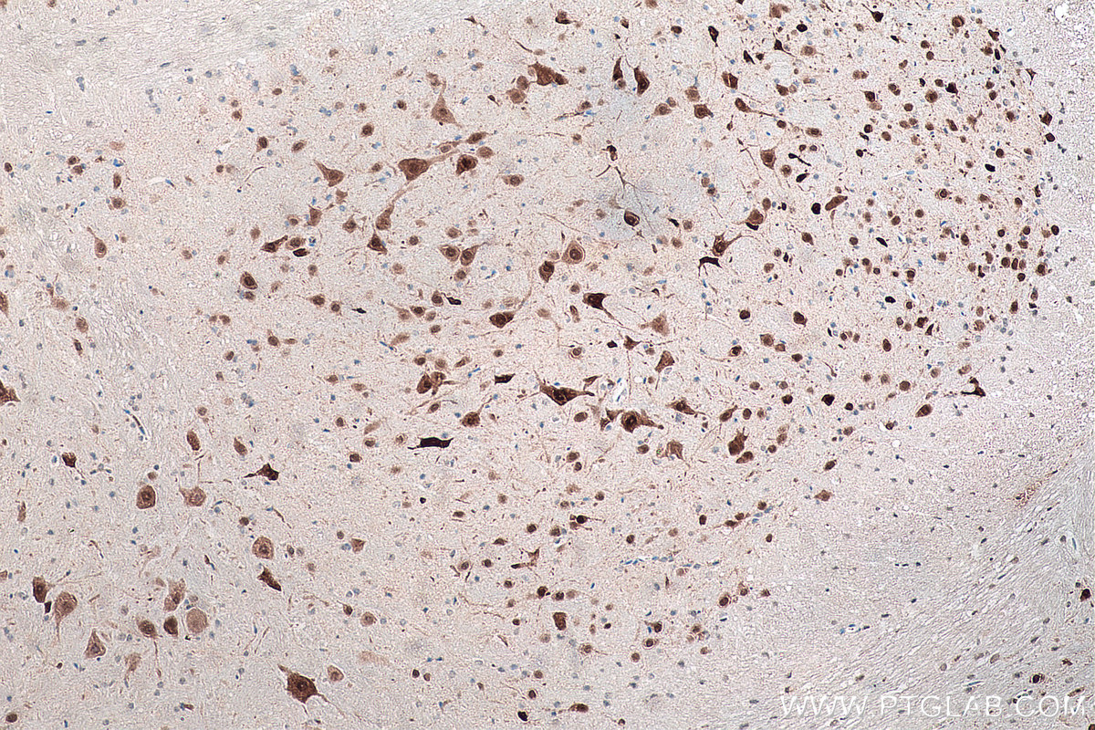 IHC staining of mouse cerebellum using 66836-1-Ig