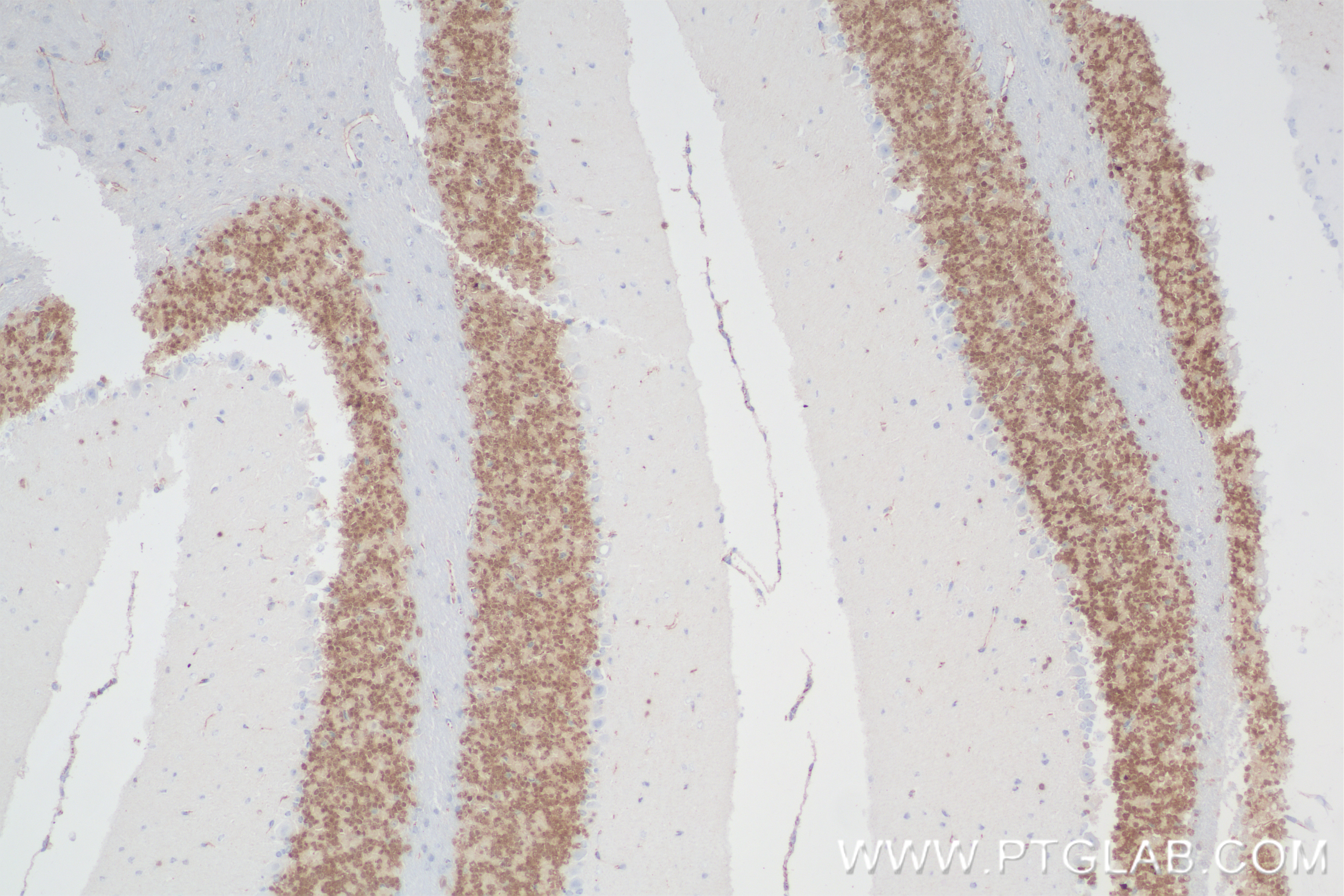 IHC staining of mouse cerebellum using 84401-4-RR