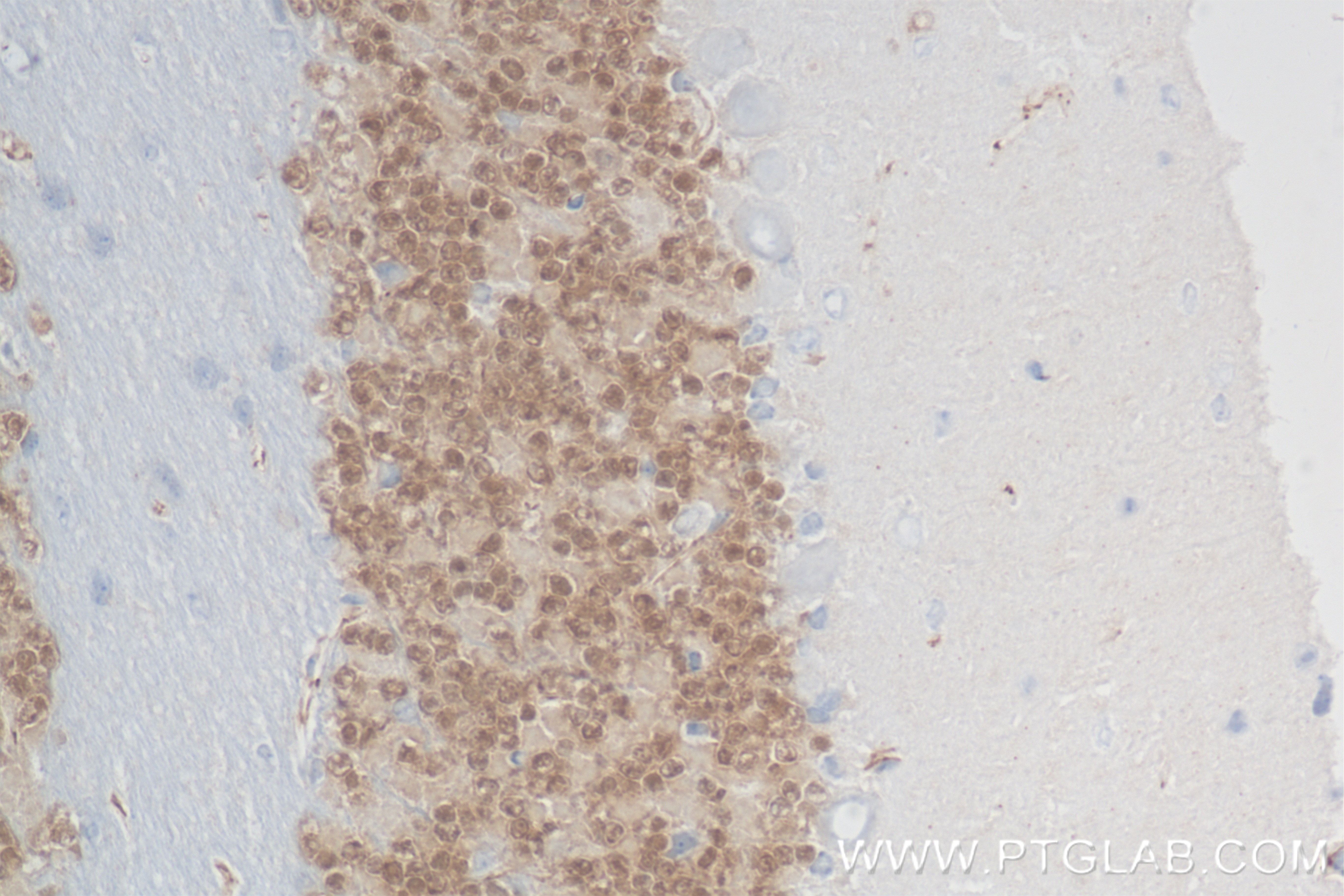 IHC staining of mouse cerebellum using 84401-4-RR