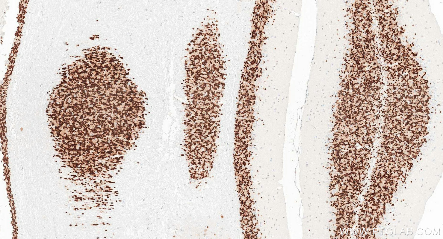 IHC staining of mouse cerebellum using 84401-4-RR IHC staining of mouse cerebellum using 84401-4-RR