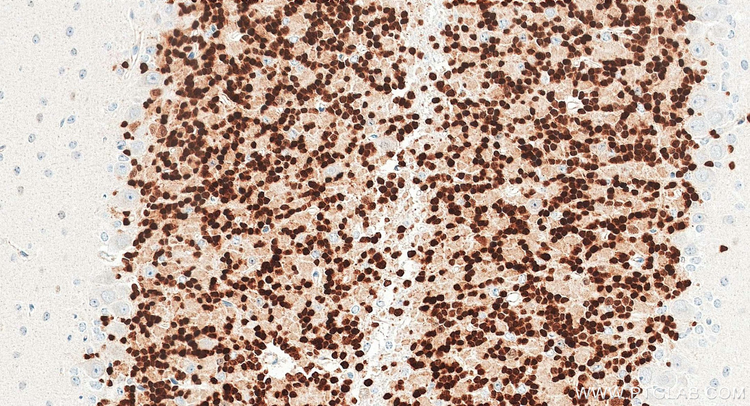 IHC staining of mouse cerebellum using 84401-4-RR IHC staining of mouse cerebellum using 84401-4-RR