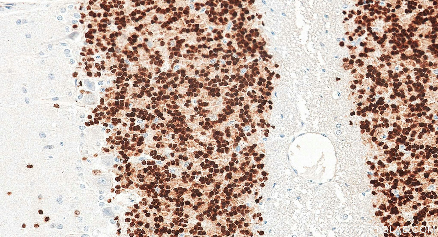 IHC staining of rat cerebellum using 84401-4-RR IHC staining of rat cerebellum using 84401-4-RR