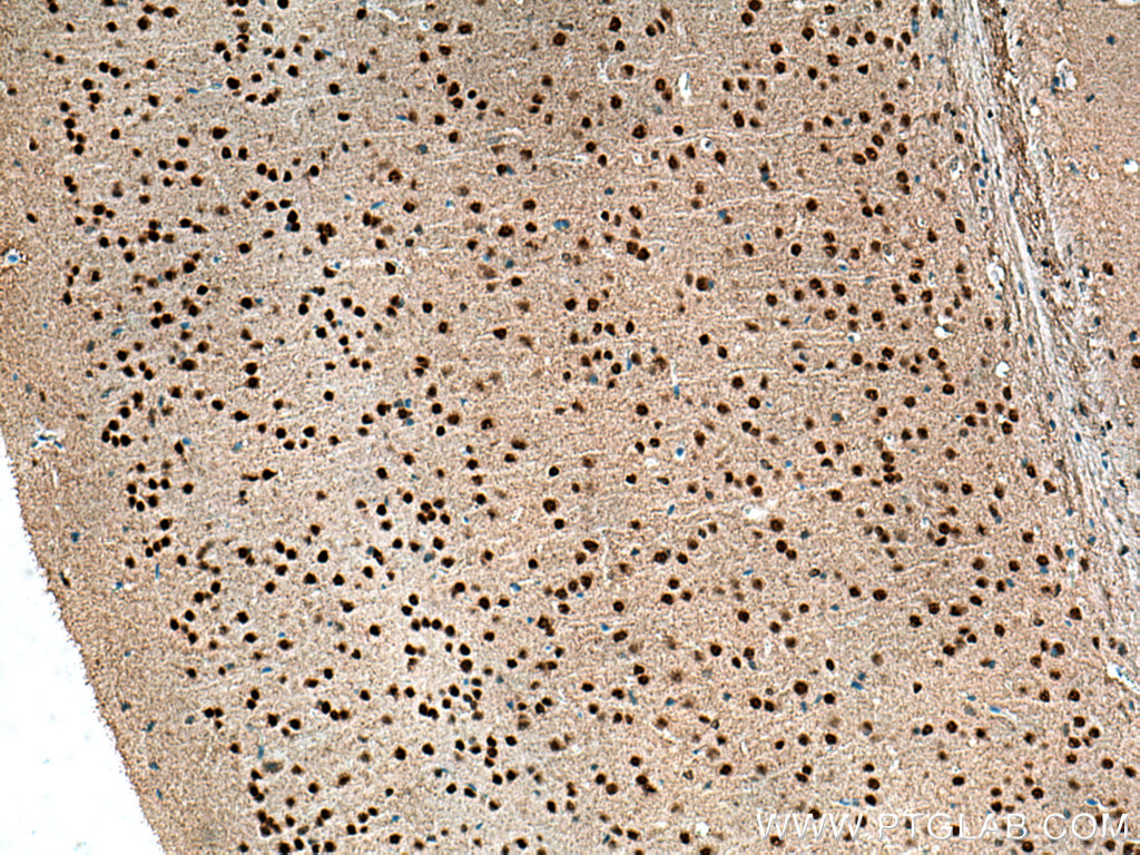 IHC staining of mouse brain using Biotin-66836