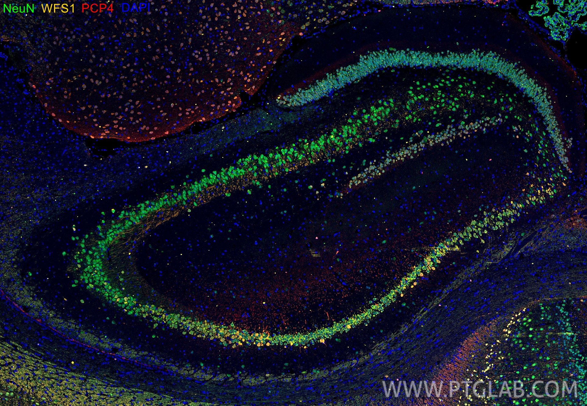 IF Staining of rat brain using CL488-26975